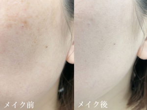 v3ファンデーションでどれだけシミは隠れるのか